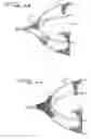 Fig. 09 - Closure device for left atrial appendage