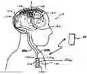 Fig. 01 - Methods and systems for establishing neural stimulation parameters and providing neural stimulation
