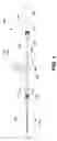 Fig. 02 - Kink resistant stent graft