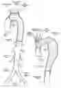Fig. 02 - Devices, systems, and methods for endovascular staple and/or prosthesis delivery and implantation