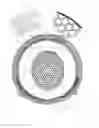 Fig. 02 - Method and device for a breast implant