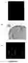 Fig. 07 - Muscle lamin A/C interacting protein, gene encoding same, and uses therefor