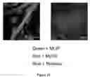 Fig. 16 - Muscle lamin A/C interacting protein, gene encoding same, and uses therefor