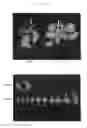Fig. 12 - Plants with improved morphogenesis and method of constructing the same