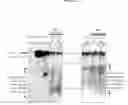 Fig. 10 - Gene silencing