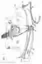 Fig. 12 - Guitar cord securing apparatus