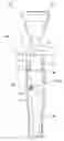 Fig. 01 - Training device for brass musical instrument