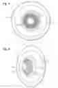 Fig. 04 - Special Resonant Side Drumhead for Live and Studio Miking Applications