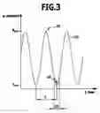 Fig. 04 - FREE-PISTON DEVICE AND METHOD FOR OPERATING A FREE-PISTON DEVICE