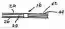 Fig. 01 - Dynamic heat exchanger