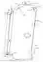 Fig. 01 - Luggage Case