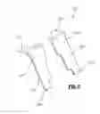 Fig. 04 - Two piece anvil for surgical stapler