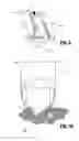 Fig. 07 - Two piece anvil for surgical stapler