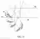 Fig. 07 - Snowboard or ski or the like having a channeled edge or multiple element edge