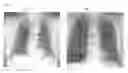 Fig. 07 - Method and system for nodule feature extraction using background contextual information in chest x-ray images