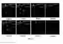 Fig. 09 - Paramagnetic Complexes with Pendant Crown Compounds Showing Improved Targeting- Specificity as MRI Contrast Agents