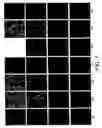 Fig. 02 - TREATMENT OF CONNECTIVE TISSUE DISORDERS