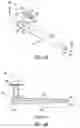 Fig. 06 - Lacrimal implants and related methods