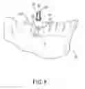 Fig. 09 - Method for designing an abutment