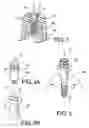 Fig. 02 - Dental framework