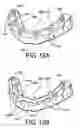 Fig. 08 - Dental framework