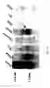 Fig. 07 - UDP-galactose:β-D-galactose-R 4-α-D-galactosyltransferase, α4gal-T1