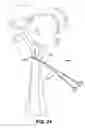 Fig. 24 - COMBINATION GRIP FOR AN EXERCISE DEVICE