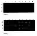 Fig. 02 - Array of nucleotidic sequences for the detection and identification of genes that codify proteins with activities relevant in biotechnology present in a microbiological sample, and method for using this array