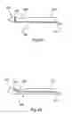 Fig. 09 - Device for cauterising tissue and uses thereof