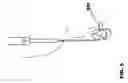 Fig. 07 - Hypodermic stiching needle