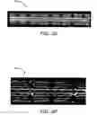 Fig. 06 - IMPLANTABLE AND LUMEN-SUPPORTING STENTS AND RELATED METHODS OF MANUFACTURE AND USE