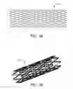 Fig. 07 - IMPLANTABLE AND LUMEN-SUPPORTING STENTS AND RELATED METHODS OF MANUFACTURE AND USE
