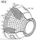 Fig. 06 - Technology for Cleaning Thermal Fatigue Cracks in Nickel-Based Superalloys With a High Chromium Content