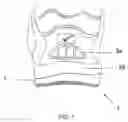 Fig. 02 - Footwear