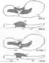 Fig. 06 - Climate configurable sole and shoe