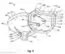Fig. 06 - Finger operated throttle