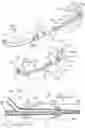 Fig. 02 - NEBULIZING CATHETER SYSTEM AND METHODS OF USE AND MANUFACTURE