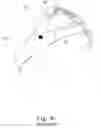 Fig. 06 - Respiratory mask assembly for stabilizing patient interface