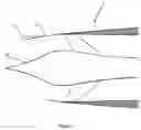 Fig. 02 - Low shock strength inlet