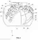 Fig. 04 - Drill bits and tools for subterranean drilling
