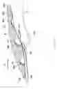 Fig. 11 - Motorcycle