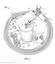 Fig. 03 - Self-cleaning filter and filtration system for lubricants