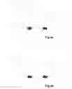Fig. 07 - Imprint lithography