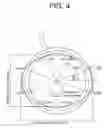 Fig. 05 - Method of fixing a stator core and an electric compressor
