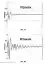 Fig. 07 - High Frequency Piezocomposite And Methods For Manufacturing Same