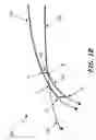 Fig. 03 - System and method for manufacturing a lens, such as an ophthalmic lens