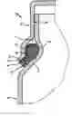 Fig. 01 - Housing for an electronic device and sealing ring for a housing