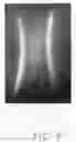 Fig. 06 - Optical plate with V-shaped protrusions on both sides and backlight module using the same