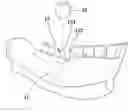 Fig. 01 - Method for designing a digital abutment for dental implant