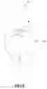 Fig. 09 - Method for designing a digital abutment for dental implant